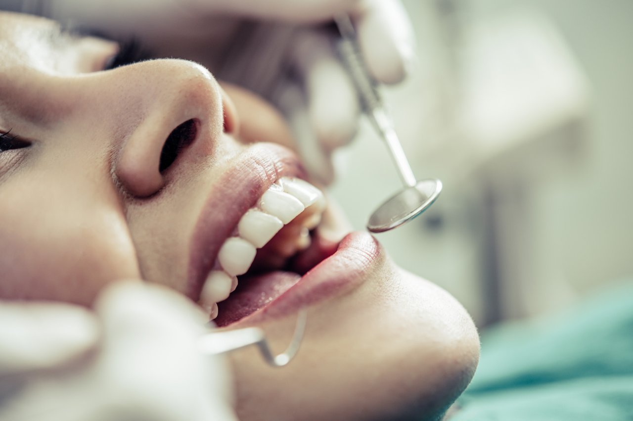 Diş Dolgusu Ankara: Analiz Dent Kliniği ile Sağlıklı ve Estetik Dişlere Kavuşun!